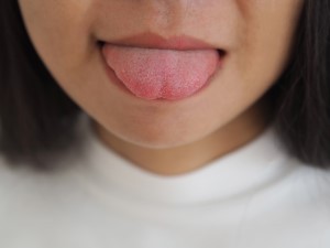 Dry mouth: How to keep your oral health flowing