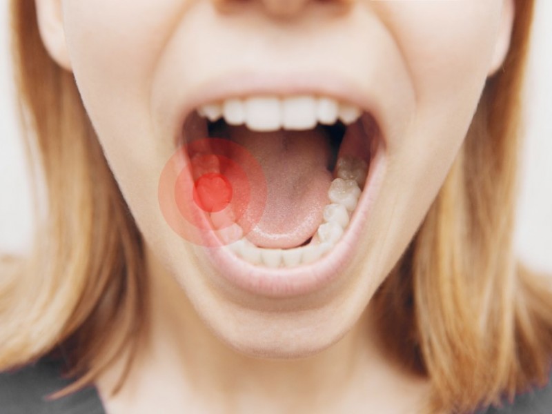 Help Prevent the Dangers of Tooth Decay