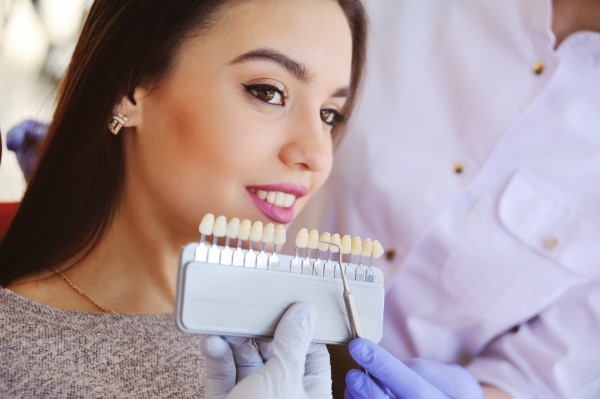 Veneers are all About Creating Beautiful Smiles