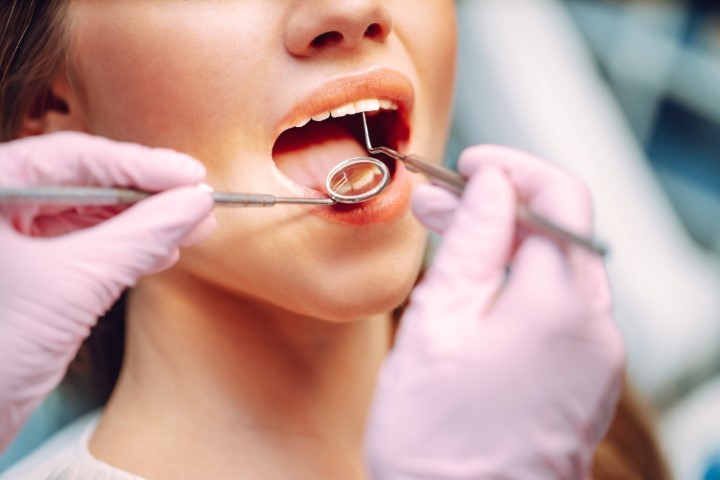 What Are Cavities? A Simple Guide to Understanding Tooth Decay.